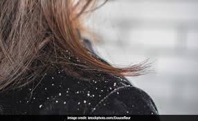 ಅಲೋವೆರಾ (ಲೋಳೆ ರಸ) ಒಂದು ಮನೆಯಲ್ಲಿದ್ದರೆ ಆರೋಗ್ಯಕ್ಕೆ ಒಳ್ಳೆಯದು, ಅಲ್ಲದೆ ವಾಸ್ತು ಪ್ರಕಾರನೂ ಒಳಿತು.