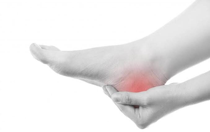 ಹಿಮ್ಮಡಿ ನೋವು