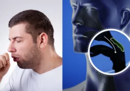 ಒಣ ಕೆಮ್ಮಿನ ಸಮಸ್ಯೆ