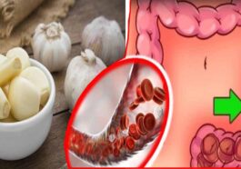 ಬೆಳ್ಳುಳ್ಳಿಯಿಂದ ಅರೋಗ್ಯ