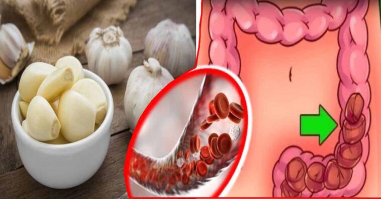 ಬೆಳ್ಳುಳ್ಳಿಯಿಂದ ಅರೋಗ್ಯ