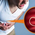 ರಕ್ತಹೀನತೆಗೆ ಕಾರಣವಾಗಿರುವ ಕೊಕ್ಕೆಹುಳು 26 ಕೊಕ್ಕೆಹುಳು