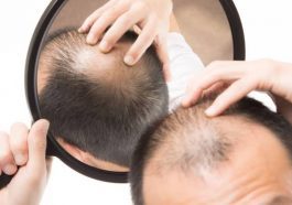 ಬೊಕ್ಕ ತಲೆಗೆ ಮನೆ ಮದ್ದು