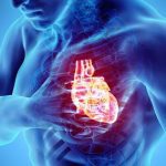 ಹೃದಯ ಸ್ತಂಭನ