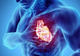 ಹೃದಯ ಸ್ತಂಭನ