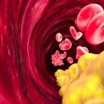 ಕೊಬ್ಬು ಮತ್ತು ಕೊಲೆಸ್ಟ್ರಾಲ್ ನಡುವಿನ ವ್ಯತ್ಯಾಸ