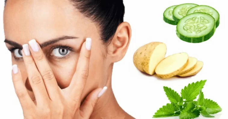 ಕಣ್ಣಿನ ಸುತ್ತ ಕಪ್ಪು ತಡೆಗಟ್ಟಲು ಈ ಕ್ರಮಗಳನ್ನು ಅನುಸರಿಸಿ