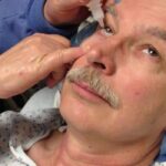 ಕಣ್ಣಿನಲ್ಲಿ ಪೊರೆ ಬರುವುದು ಹೇಗೆ? ಕಾರಣ ಏನಿರಬಹುದು? 26 ಕಣ್ಣಿನಲ್ಲಿ ಪೊರೆ