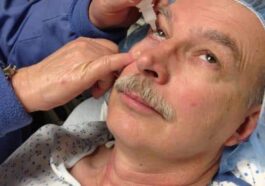 ಕಣ್ಣಿನಲ್ಲಿ ಪೊರೆ